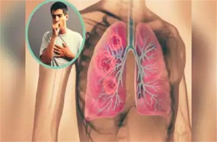 2025_2image_12_37_135150697cancer1-ll