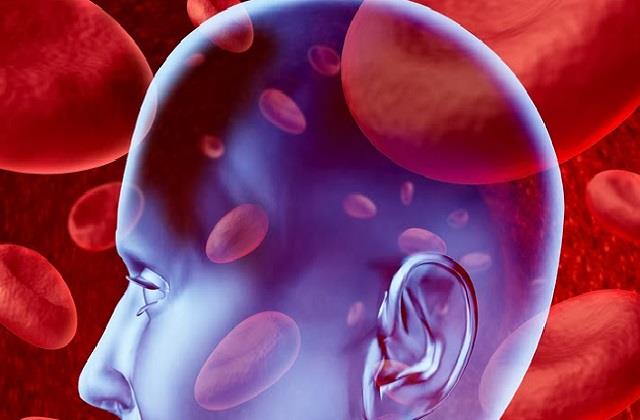 2025_2image_20_04_234124877minibrainstroke1-ll