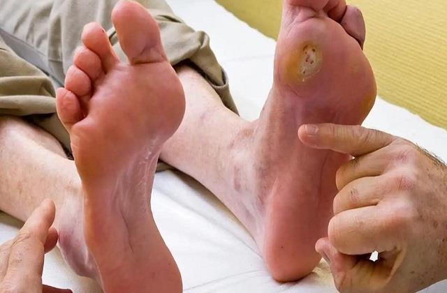 2025_2image_21_08_165220450bloodsugarsymptomsonfee-ll