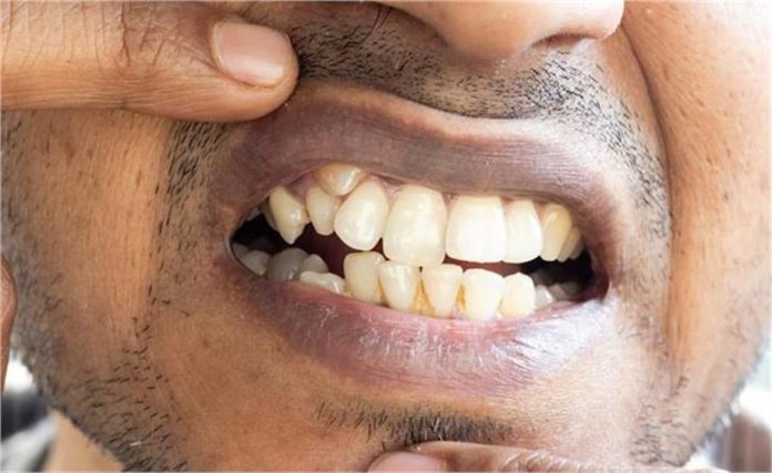 2025_3image_07_57_156147887meerut-ll