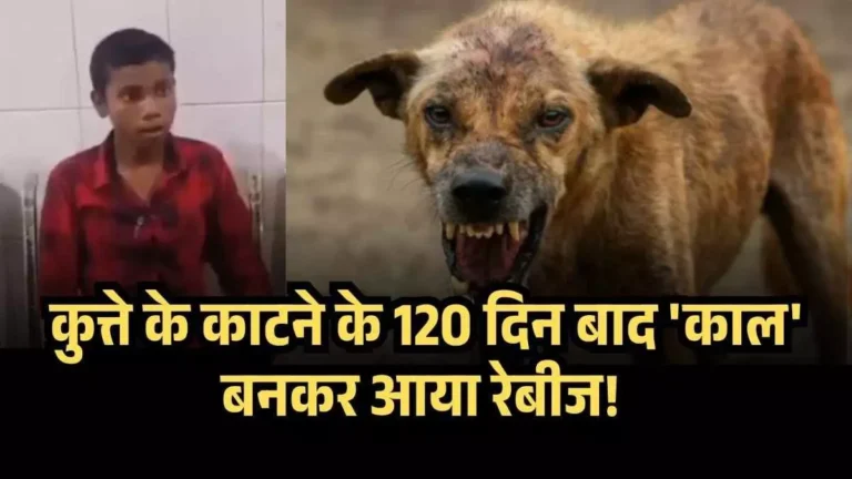 Trending : 4 महीने पहले हुई थी डॉग बाइट, अब कुत्ते की तरह भौंक रहा ये बच्चा