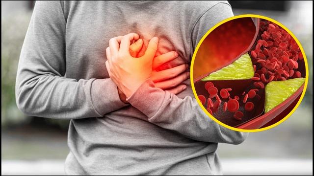 2025_1image_12_32_071575381heartattack-ll (1)