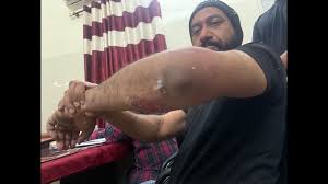 images - 2025-03-22T125422.781