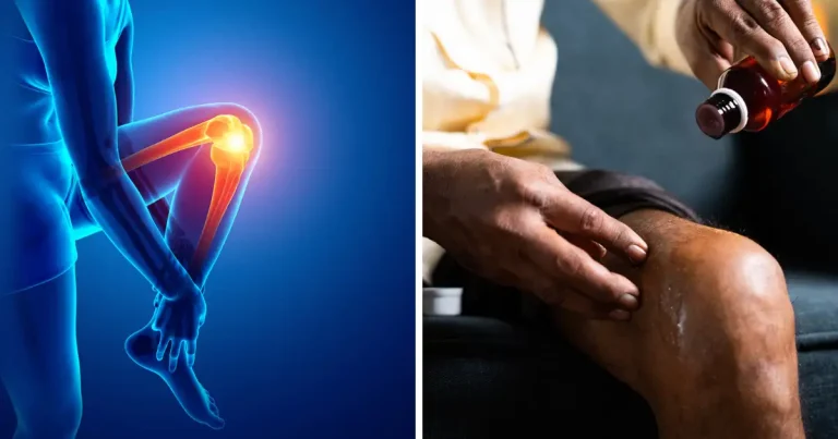 HEALTH : जवानी में की गई इस गलती की वजह से घुटने हो जाते हैं खराब, तुरंत बरतें ये सावधानी