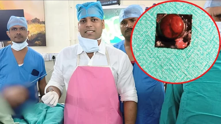 MP : मरीज ने दवा के संग निगल लिया नुकीला रैपर, भीतरी परत पर बने घाव, इलाज न मिलता तो फट सकती थी आहार नली